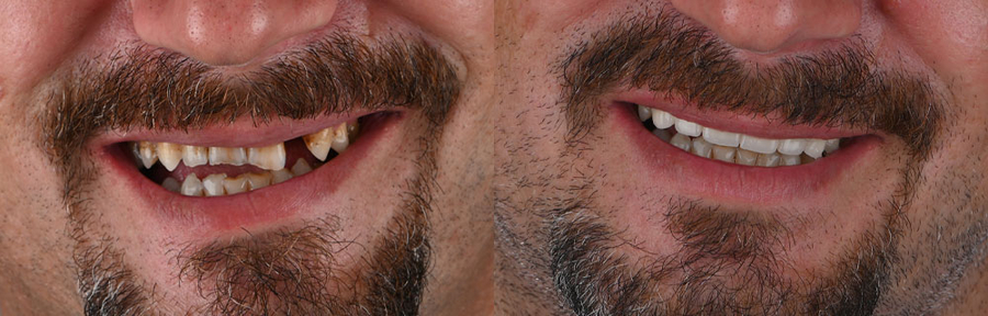 Slider image (2) Dentleon Polyclinics